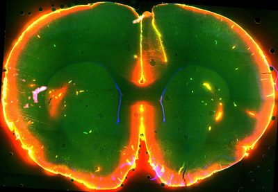 Scientists watched dye flow through the brain of a sleeping mouse.  Courtesy of Nedergaard Lab, University of Rochester Medical Center.